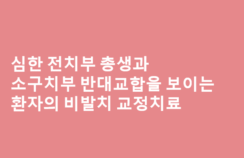 심한 전치부 총생과 소구치부 반대교합을 보이는 환자의 비발치 교정치료