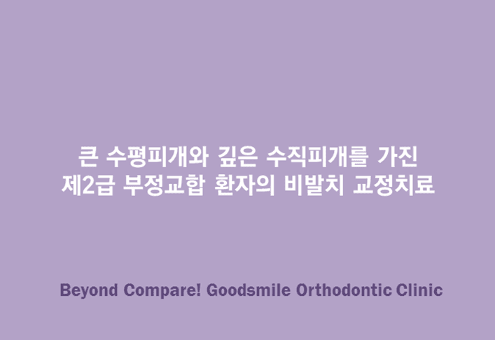 큰 수평피개와 깊은 수직피개를 가진 제2급 부정교합 환자의 비발치 교정치료