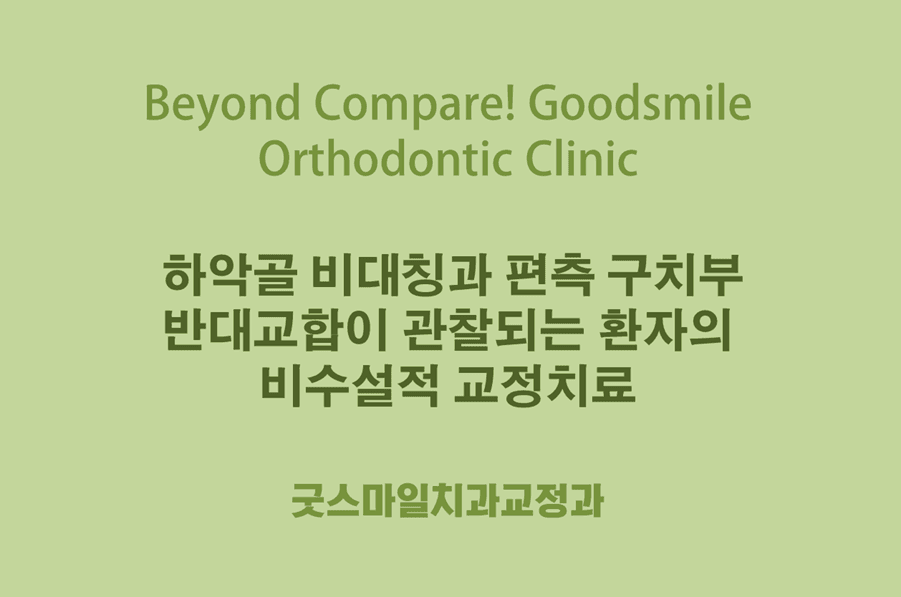 하악골 비대칭과 편측 구치부 반대교합이 관찰되는 환자의 비수설적 교정치료 굿스마일치과교정과