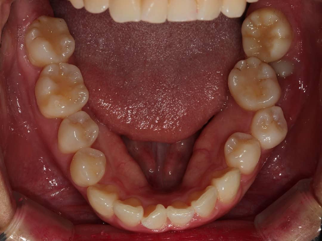 정말 말도 안되는 걸 잘 빨리 세워서 정말 멋있다 잘한다 했더니
우리 선생님들은 원장님 …