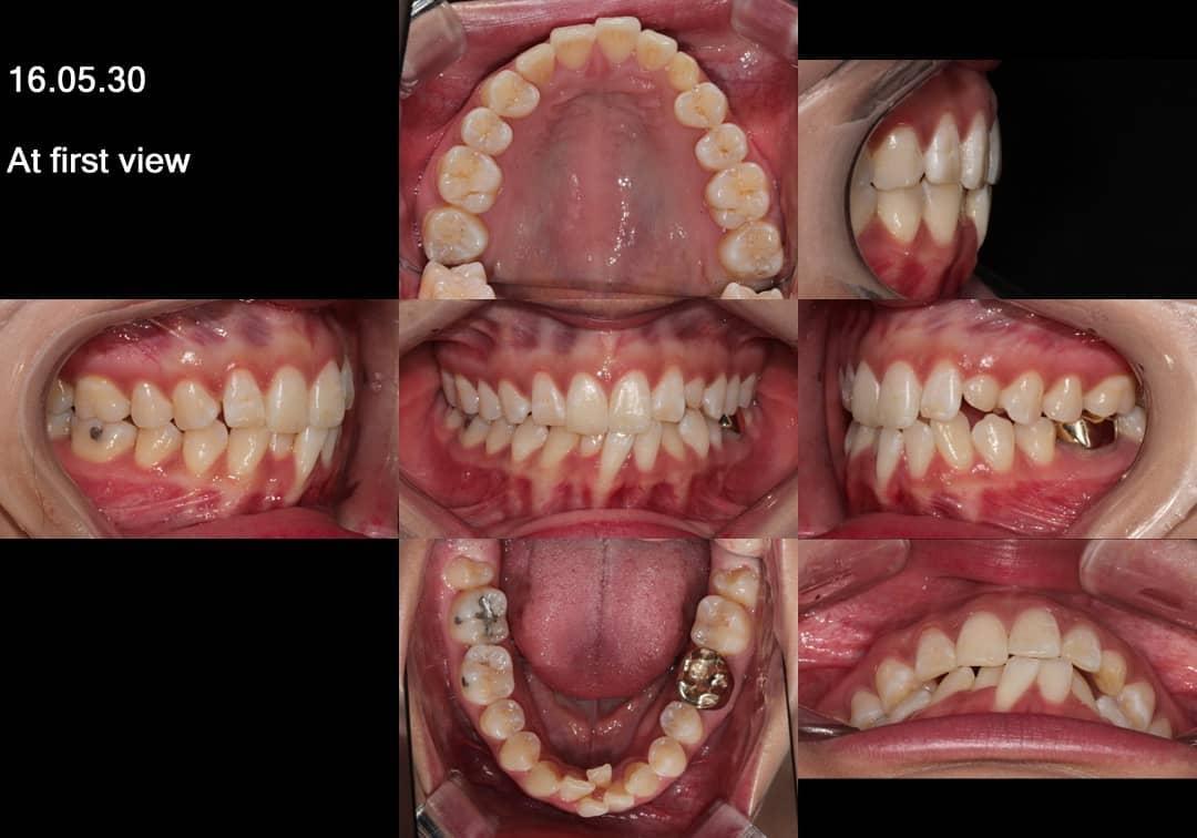 Could you imagine how difficult this treatment was…