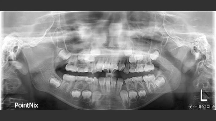 Treatment effects of Phase I
1. 2×4 fixed applia…