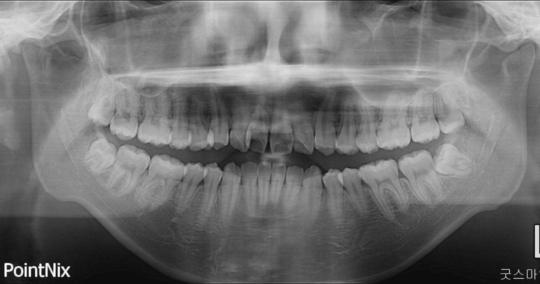 we can easily encounter patients who have TMJ prob…