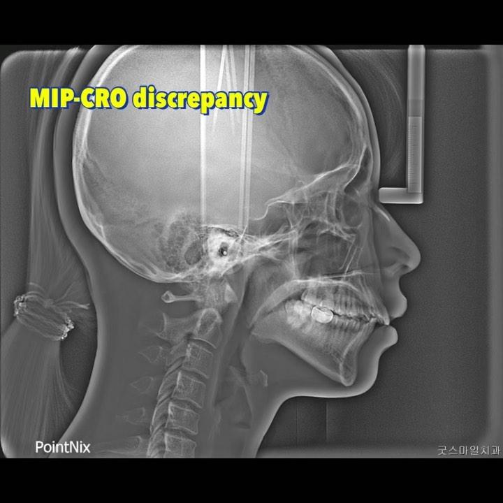 CR CO DISCREPANCY
#blackshaqgoodsmile #totalarch…