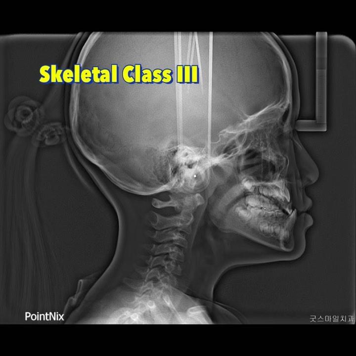 What’s your take on this case??
Two phase treatme…