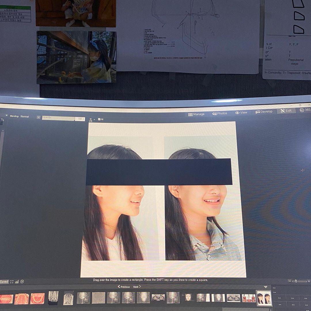 너무 예쁘다 미소가
오늘 다섯시 오십분부터 디본딩 준비해서 여섯시 오십분에 끝냈다
픽스드…