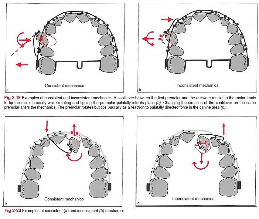 consistent vs inconsistent force system
#biomecha…