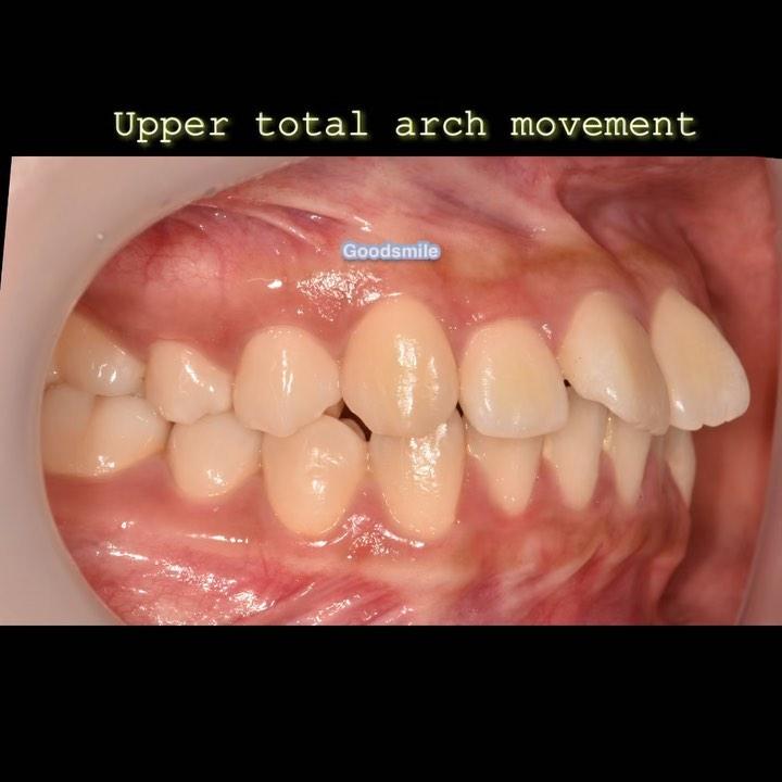 Changes of six months treatment
When you decide e…
