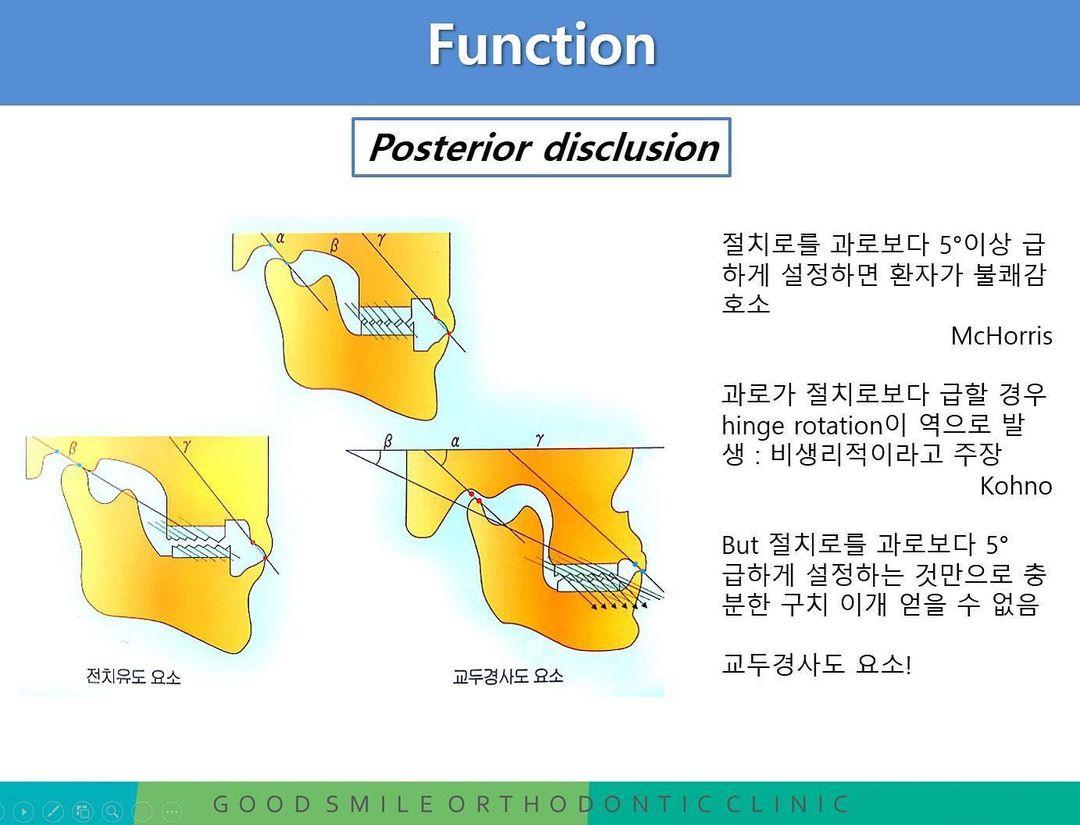 What’s your take on this?
일단 저는 gnathologist가 아닙니…