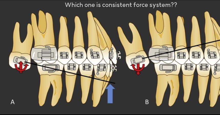 Consistent? or inconsistent??
What is a dissociat…