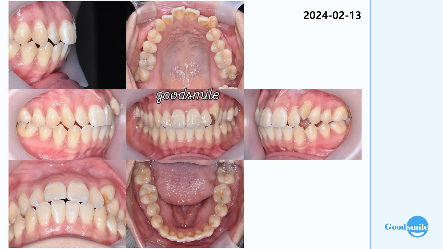#blackshaqgoodsmile…