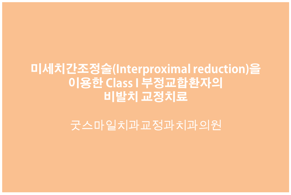 미세치간조정술(Interproximal reduction)을 이용한 Class I…