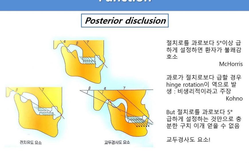 What’s your take on this? 일단 저는 gnathologist가 아닙니…