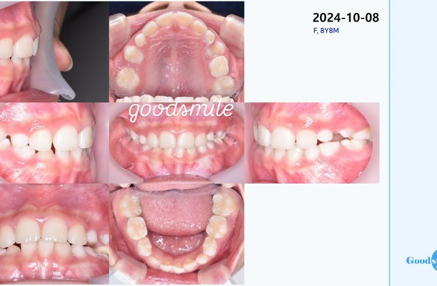 space regaining #blackshaqgoodsmile…