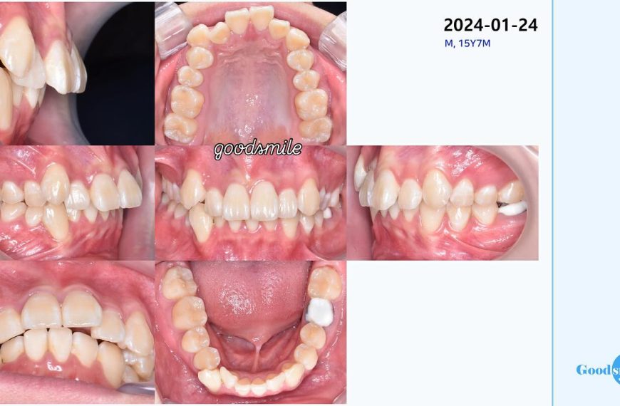 upper 4 ext #blackshaqgoodsmile…